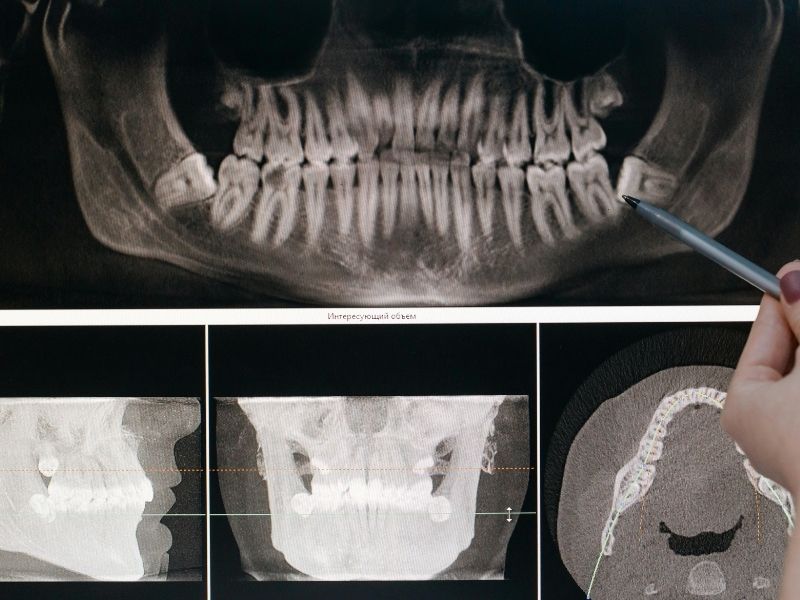 Facial-Trauma