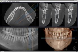 CT-Guided Surgery